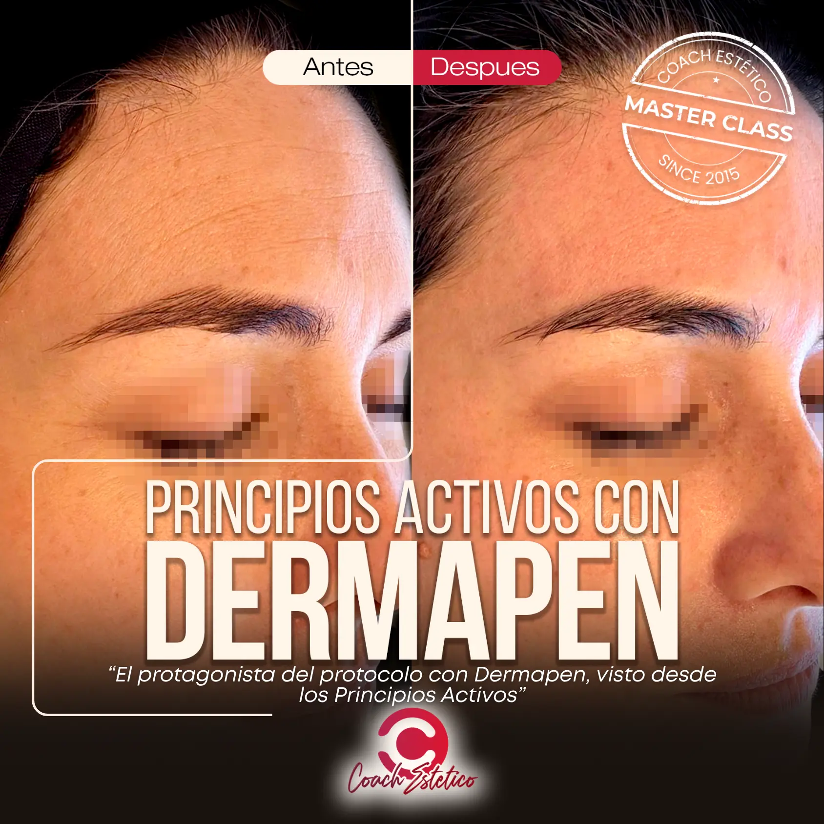 Portada oficial de la Master Class Principios Activos con Dermapen
