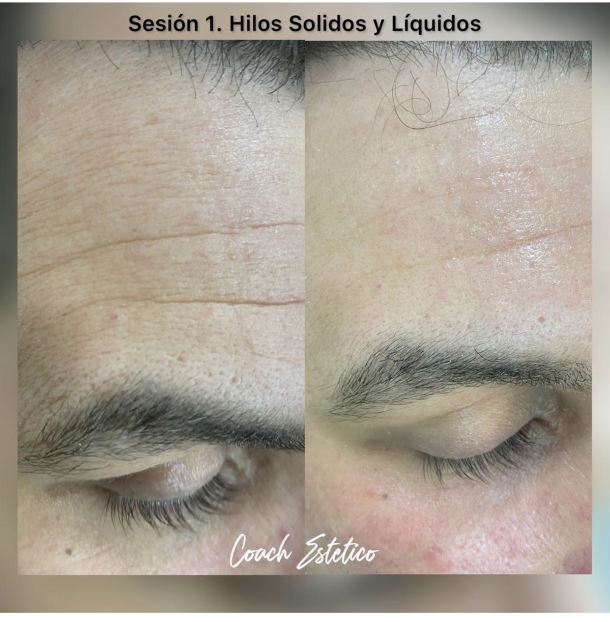 Antes y después — Hilos sólidos y líquidos